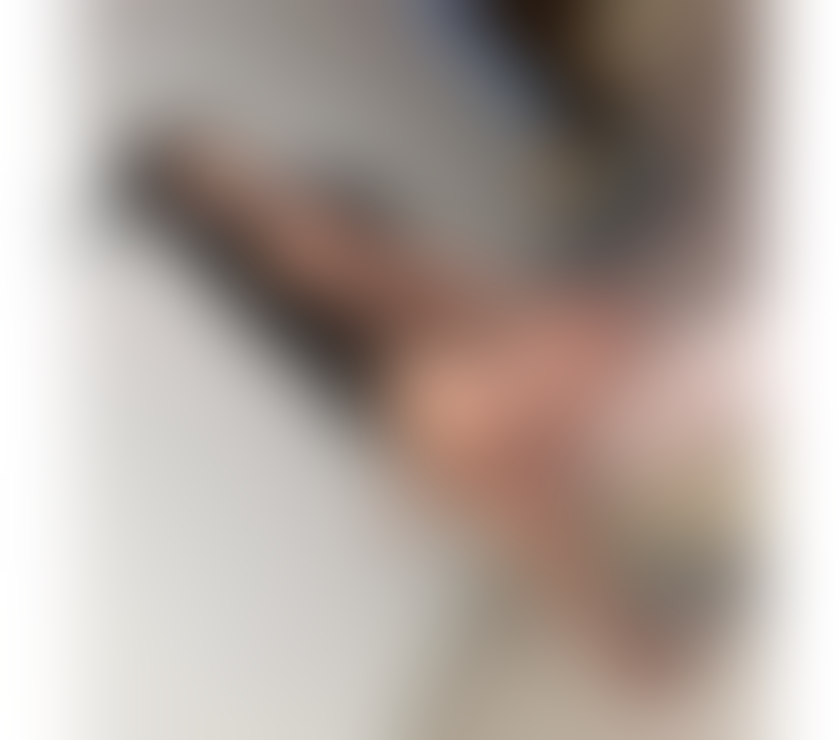 Escorts South East London Blackheath - South East London - Photos for 🎀Sibel🎀 💎Lovely Girl 🎀 Avalaible 24h